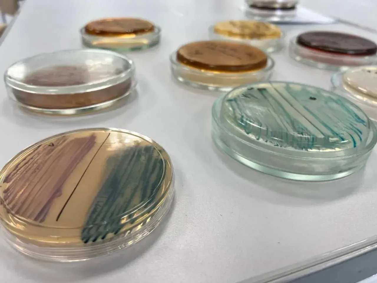 Тест на «бактерии стройности» из Башкортостана